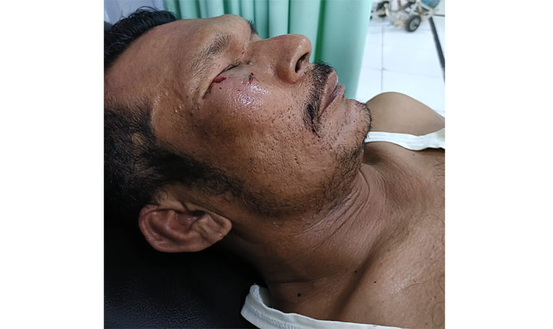 Ayub kelana, wartawan online lokal mengalami korban pemukulan aksi ricuh penertiban PETI oleh tim gabungan di Desa Pulau Bayur Kecamatan Cerenti, Selasa (7/10/2025).