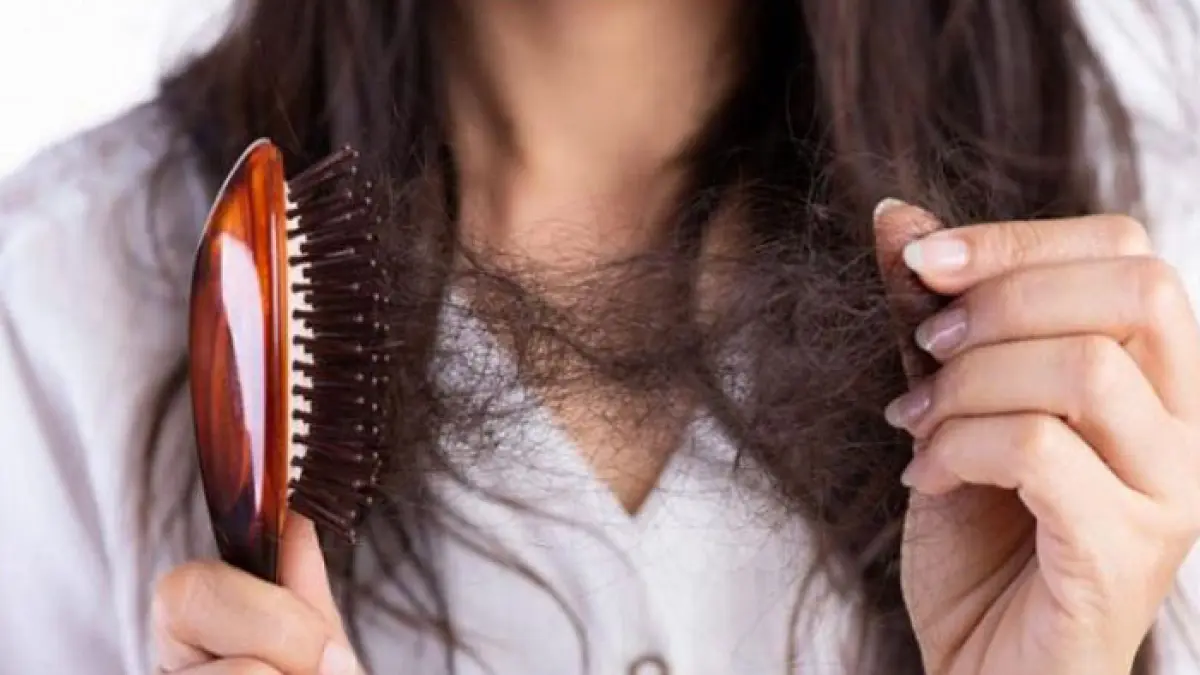 Ilustrasi rambut rontok. (Pexels)