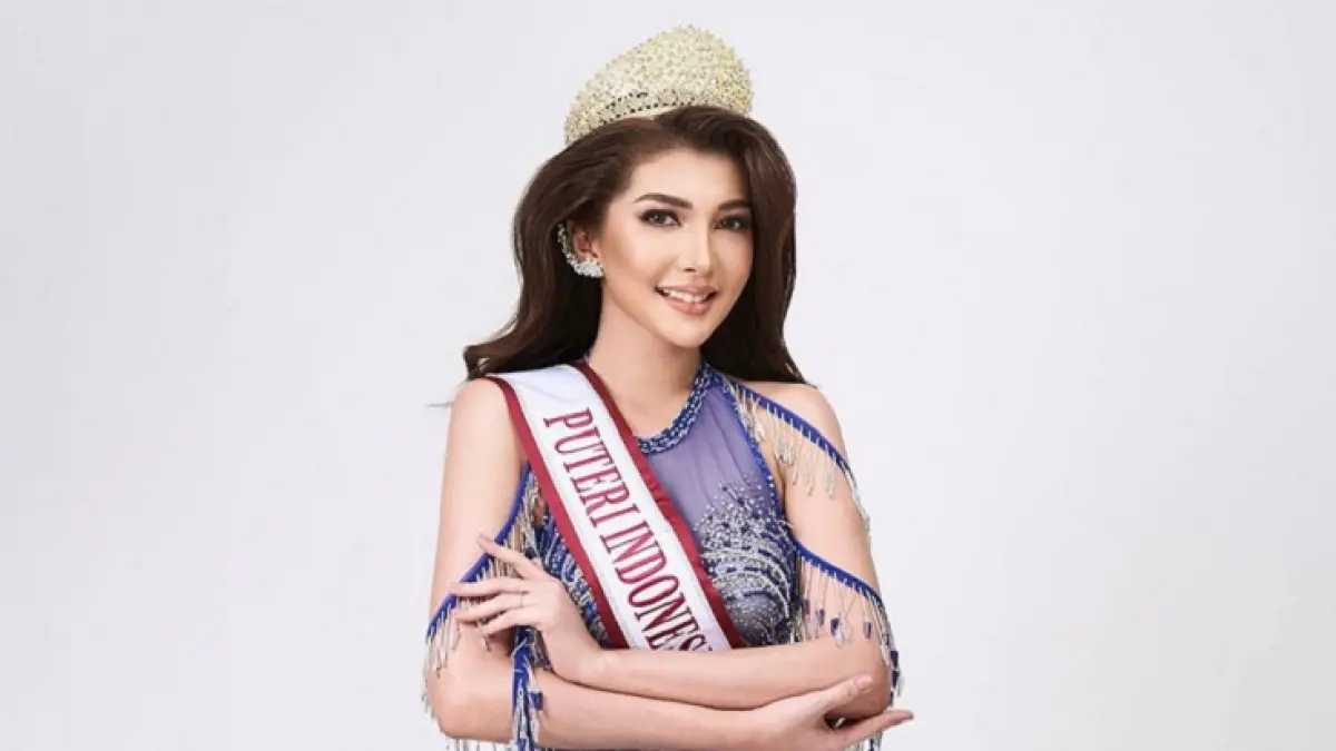 Mantan Putri Riau 2024 Jeni Rahmadial Fitri tersandung praktik dokter kecantikan ilegal. (Istimewa)