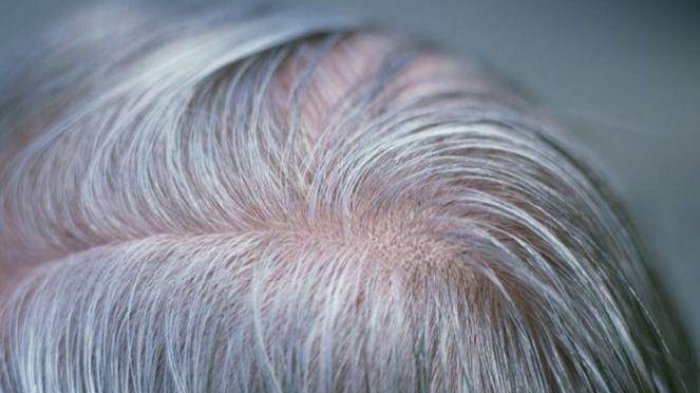 Rambut uban.(int)