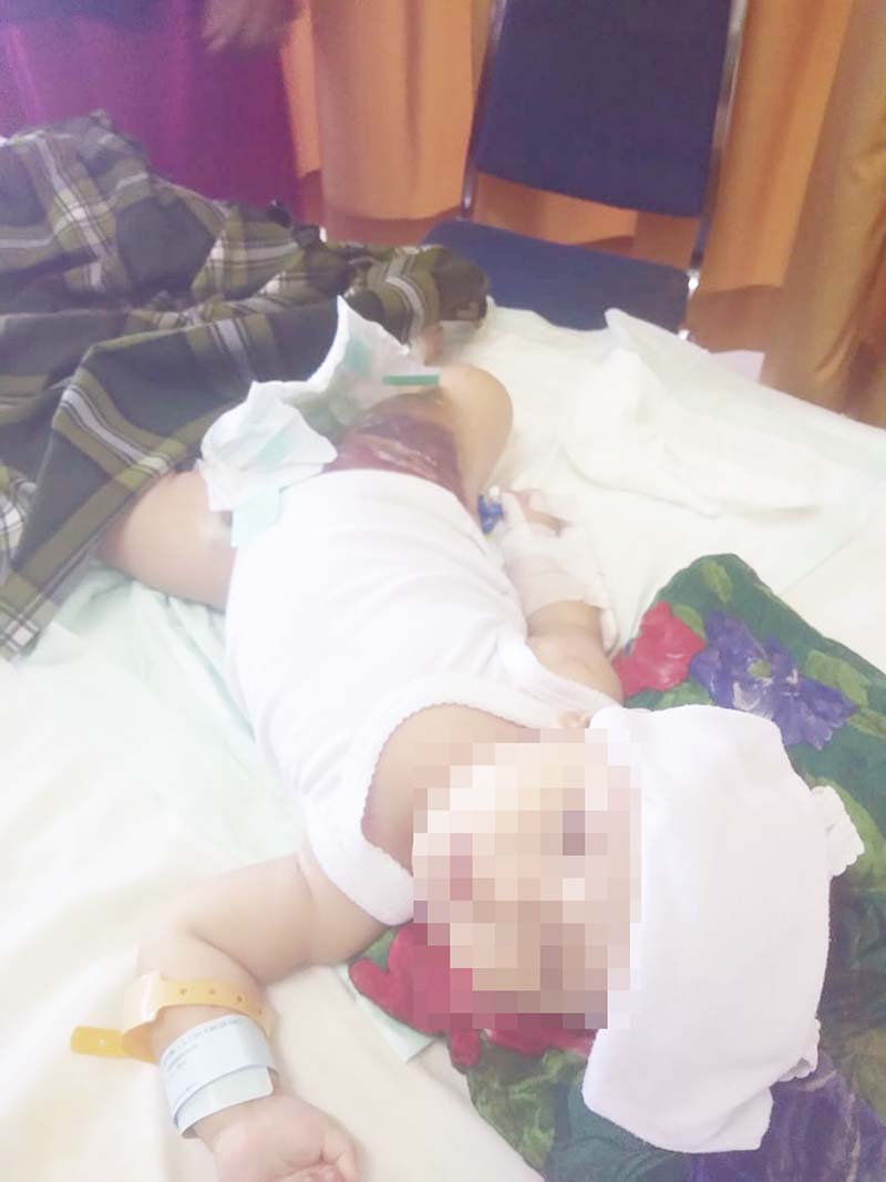 MEMPRIHATINKAN: Arfan, bayi dari pasangan Rusman (ayah) dan Kamisa (ibu) warga Desa Teluk Buntal, Kecamatan Tebingtinggi Kabupaten Kepulauan Meranti dengan kondisi memprihatinkan, Ahad (1/12/2019). (Wira saputra/riau pos)