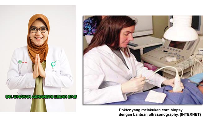 Tumor Payudara Jinak atau Ganas, Tidak Perlu Operasi untuk Mengetahuinya
