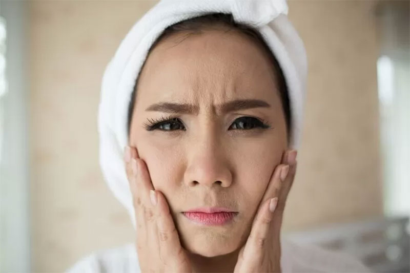 Penyebab kulit wajah mengelupas.