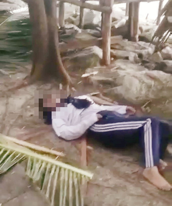 Seorang mahasiswi KKN IATF Dumai tergeletak usai disambar petir bersama ayahnya di Pantai Tanjung Lapin, Desa Tanjung Punak, Kecamatan Rupat Utara, Rabu (17/8/2022).